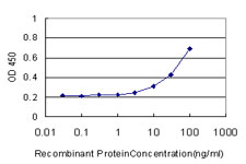CA8 / Carbonic Anhydrase VIII Antibody - Detection limit for recombinant GST tagged CA8 is approximately 3 ng/ml as a capture antibody.