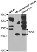 CA8 / Carbonic Anhydrase VIII Antibody - Western blot analysis of extracts of various cell lines.