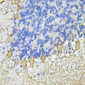 CA8 / Carbonic Anhydrase VIII Antibody - Immunohistochemistry of paraffin-embedded Mouse cerebellum using CA8 Polyclonal Antibody at dilution of 1:100 (40x lens).