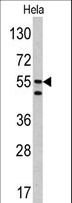 CA9 / Carbonic Anhydrase IX Antibody - Western blot of CA9 antibody in HeLa cell line lysates (35 ug/lane). CA9 (arrow) was detected using the purified antibody.