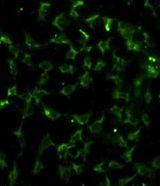 CA9 / Carbonic Anhydrase IX Antibody - Immunofluorescence of CA9 Antibody with HeLa cells. 0.025 mg/ml primary antibody was followed by FITC-conjugated goat anti-rabbit lgG (whole molecule). FITC emits green fluorescence.