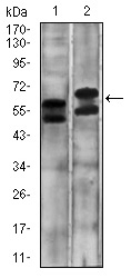 CA9 / Carbonic Anhydrase IX Antibody - Western blot using CA9 mouse monoclonal antibody against A431 (1) and SW620 (2) cell lysate.