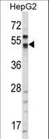 CA9 / Carbonic Anhydrase IX Antibody - Western blot of CA9/G250:78-89 in HepG2 cell line lysates (35 ug/lane). CA9 (arrow) was detected using the purified antibody.