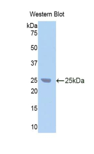 CA9 / Carbonic Anhydrase IX Antibody - Western blot of recombinant CA9 / Carbonic Anhydrase IX.  This image was taken for the unconjugated form of this product. Other forms have not been tested.