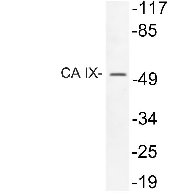 CA9 / Carbonic Anhydrase IX Antibody - Western blot of CA IX (D82) pAb in extracts from 293 cells treated with insulin.