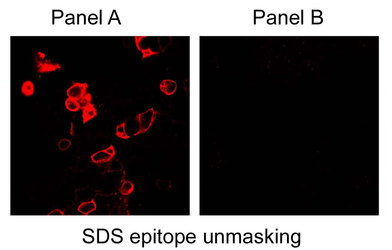 CA9 / Carbonic Anhydrase IX Antibody - Immunofluorescence of HEK 293 cells. Panel A shows CAIX-transfected cells (epitope-unmasked with SDS) and panel B shows mock transfected cells.  This image was taken for the unconjugated form of this product. Other forms have not been tested.