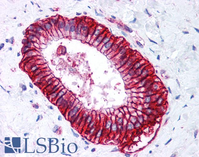 CA9 / Carbonic Anhydrase IX Antibody - Anti-CA9 / Carbonic Anhydrase IX antibody IHC of human liver. Immunohistochemistry of formalin-fixed, paraffin-embedded tissue after heat-induced antigen retrieval. Antibody concentration 5 ug/ml.  This image was taken for the unconjugated form of this product. Other forms have not been tested.