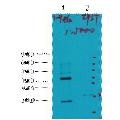 CA9 / Carbonic Anhydrase IX Antibody - Western blot of CA IX antibody