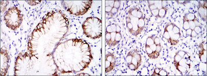 CA9 / Carbonic Anhydrase IX Antibody - IHC of paraffin-embedded stomach tissues (left) and colon tissues (right) using CA9 mouse monoclonal antibody with DAB staining.