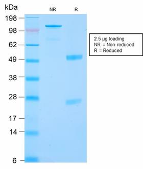 CA9 / Carbonic Anhydrase IX Antibody - SDS-PAGE Analysis Purified RCC Rabbit Recombinant Monoclonal Antibody (CA9/2993R). Confirmation of Purity and Integrity of Antibody.
