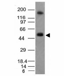 CA9 / Carbonic Anhydrase IX Antibody - Western blot analysis of HCT116 cell lysate using CAIX antibody (CA9/781). Predicted molecular weight: 50-55 kDa.  This image was taken for the unmodified form of this product. Other forms have not been tested.