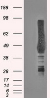 CA9 / Carbonic Anhydrase IX Antibody - HEK293T cells were transfected with the pCMV6-ENTRY control (Left lane) or pCMV6-ENTRY CA9 (Right lane) cDNA for 48 hrs and lysed. Equivalent amounts of cell lysates (5 ug per lane) were separated by SDS-PAGE and immunoblotted with anti-CA9.