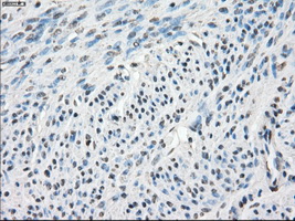 CA9 / Carbonic Anhydrase IX Antibody - IHC of paraffin-embedded endometrium tissue using anti-CA9 mouse monoclonal antibody. (Dilution 1:50).