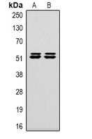 CA9 / Carbonic Anhydrase IX Antibody - Western blot analysis of Carbonic Anhydrase 9 expression in HeLa (A); 293T (B) whole cell lysates.