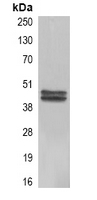 CA9 / Carbonic Anhydrase IX Antibody - Immunoprecipitation of Carbonic Anhydrase 9 from 0.5mg HeLa whole cell extract lysate; using Anti-Carbonic Anhydrase 9 Antibody Antibody.