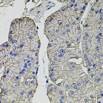 CA9 / Carbonic Anhydrase IX Antibody - Immunohistochemistry of paraffin-embedded human stomach using CA9 antibody at dilution of 1:100 (40x lens).