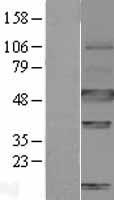 CA9 / Carbonic Anhydrase IX Protein - Western validation with an anti-DDK antibody * L: Control HEK293 lysate R: Over-expression lysate