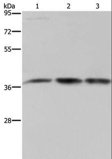 CAB39 / MO25 Antibody - Western blot analysis of 293T and LoVo cell, human brain malignant glioma tissue, using CAB39 Polyclonal Antibody at dilution of 1:450.