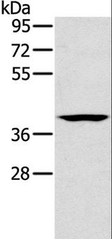 CAB39 / MO25 Antibody - Western blot analysis of Lovo cell, using CAB39 Polyclonal Antibody at dilution of 1:200.