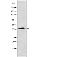 CAB39 / MO25 Antibody - Western blot analysis of CAB39 using HepG2 whole lysates.