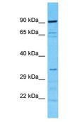 CAB39L Antibody - CAB39L antibody Western Blot of HeLa. Antibody dilution: 1 ug/ml.  This image was taken for the unconjugated form of this product. Other forms have not been tested.