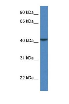 CAB39L Antibody - CAB39L antibody Western blot of COL0205 Cell lysate. Antibody concentration 1 ug/ml.  This image was taken for the unconjugated form of this product. Other forms have not been tested.