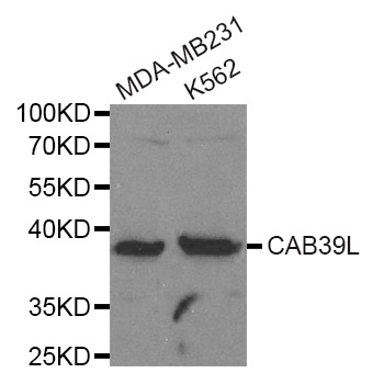 CAB39L Antibody - Western blot analysis of extracts of various cell lines, using CAB39L antibody.