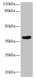 CAB39L Antibody - Western blot All lanes: CAB39L antibody at 10µg/ml + 293T whole cell lysate Secondary Goat polyclonal to rabbit IgG at 1/10000 dilution Predicted band size: 39 kDa Observed band size: 39 kDa