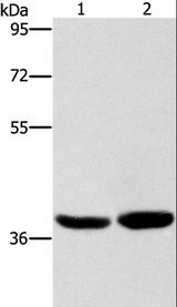 CAB39L Antibody - Western blot analysis of Human fetal brain tissue and 231 cell, using CAB39L Polyclonal Antibody at dilution of 1:400.