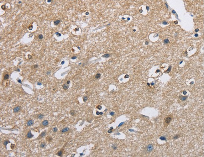 CAB39L Antibody - Immunohistochemistry of paraffin-embedded Human brain using CAB39L Polyclonal Antibody at dilution of 1:40.