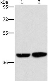 CAB39L Antibody - Western blot analysis of Human fetal brain tissue and 231 cell, using CAB39L Polyclonal Antibody at dilution of 1:350.