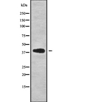 CAB39L Antibody - Western blot analysis of CAB39L using COS7 whole cells lysates