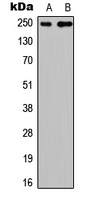 CABIN1 Antibody - Western blot analysis of CABIN1 expression in HEK293T (A); PC12 (B) whole cell lysates.