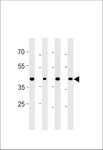CABLES2 Antibody - CABLES2 Antibody western blot of PC-3 cell line and mouse brain,testis and liver lysates (35 ug/lane). The CABLES2 antibody detected the CABLES2 protein (arrow).