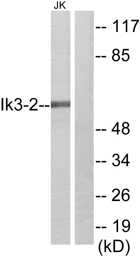 CABLES2 Antibody - Western blot analysis of lysates from Jurkat cells, using Ik3-2 Antibody. The lane on the right is blocked with the synthesized peptide.