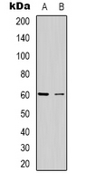 CABLES2 Antibody - Western blot analysis of CABLES2 expression in HeLa (A); Jurkat (B) whole cell lysates.