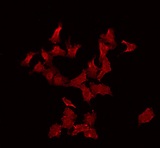 CABLES2 Antibody - Staining HeLa cells by IF/ICC. The samples were fixed with PFA and permeabilized in 0.1% Triton X-100, then blocked in 10% serum for 45 min at 25°C. The primary antibody was diluted at 1:200 and incubated with the sample for 1 hour at 37°C. An Alexa Fluor 594 conjugated goat anti-rabbit IgG (H+L) Ab, diluted at 1/600, was used as the secondary antibody.