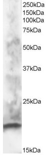 CABP / CABP1 Antibody - Antibody staining (1 ug/ml) of human brain lysate (RIPA buffer, 30 ug total protein per lane). Primary incubated for 1 hour. Detected by Western blot of chemiluminescence.