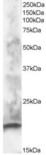 CABP / CABP1 Antibody - Antibody staining (1 ug/ml) of human brain lysate (RIPA buffer, 30 ug total protein per lane). Primary incubated for 1 hour. Detected by Western blot of chemiluminescence.