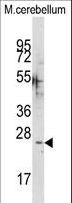 CABP / CABP1 Antibody - Western blot of anti-CABP1 Antibody in mouse cerebellum tissue lysates (35 ug/lane). CABP1(arrow) was detected using the purified antibody.