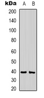 CABP / CABP1 Antibody - Western blot analysis of CABP1 expression in mouse brain (A); rat brain (B) whole cell lysates.