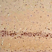 CABP / CABP1 Antibody - Immunohistochemical analysis of CABP1 staining in rat brain formalin fixed paraffin embedded tissue section. The section was pre-treated using heat mediated antigen retrieval with sodium citrate buffer (pH 6.0). The section was then incubated with the antibody at room temperature and detected using an HRP conjugated compact polymer system. DAB was used as the chromogen. The section was then counterstained with hematoxylin and mounted with DPX.