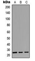 CABP2 Antibody - Western blot analysis of CABP2 expression in A549 (A); NS-1 (B); H9C2 (C) whole cell lysates.