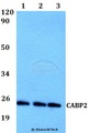 CABP2 Antibody - Western blot of CABP2 antibody at 1:500 dilution. Lane 1: A549 whole cell lysate. Lane 2: sp2/0 whole cell lysate. Lane 3: H9C2 whole cell lysate.