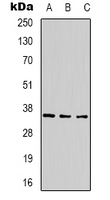 CABP2 Antibody - Western blot analysis of CABP2 expression in 293T (A); mouse brain (B); rat brain (C) whole cell lysates.