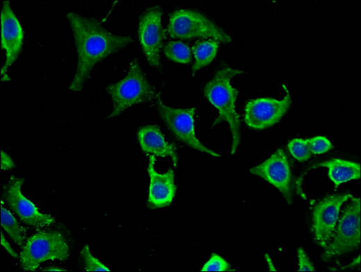 CABP2 Antibody - Immunofluorescent analysis of HepG2 cells using CABP2 Antibody at a dilution of 1:100 and Alexa Fluor 488-congugated AffiniPure Goat Anti-Rabbit IgG(H+L)