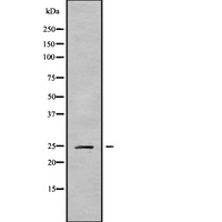 CABP2 Antibody - Western blot analysis of CABP2 using MCF-7 whole cells lysates