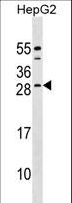 CABP4 Antibody - CABP4 Antibody western blot of HepG2 cell line lysates (35 ug/lane). The CABP4 antibody detected the CABP4 protein (arrow).