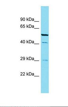 CABP4 Antibody - Western blot of Rat Lung. Cabp4 antibody dilution 1.0 ug/ml.  This image was taken for the unconjugated form of this product. Other forms have not been tested.