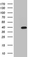 CABP4 Antibody - HEK293T cells were transfected with the pCMV6-ENTRY control. (Left lane) or pCMV6-ENTRY CABP4. (Right lane) cDNA for 48 hrs and lysed. Equivalent amounts of cell lysates. (5 ug per lane) were separated by SDS-PAGE and immunoblotted with anti-CABP4. (1:500)
